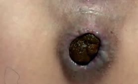 Closeup shit