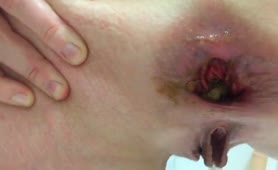 slut pushes out plug followed by shit and piss