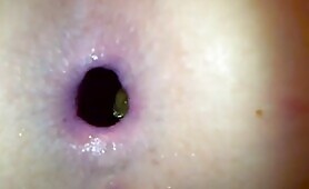 Girl Gapes Her Anus While Pooping 