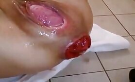 Plug scat prolaps fist